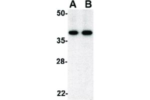 Image no. 1 for anti-Budding Uninhibited By Benzimidazoles 3 Homolog (Yeast) (BUB3) (C-Term) antibody (ABIN6655917)