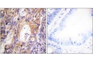Image no. 2 for anti-Met Proto-Oncogene (MET) (AA 976-1025), (pTyr1003) antibody (ABIN1531559)