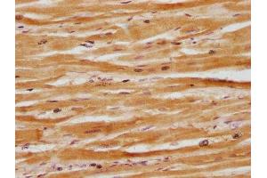 IHC image of ABIN7164419 diluted at 1:100 and staining in paraffin-embedded human heart tissue performed on a Leica BondTM system.