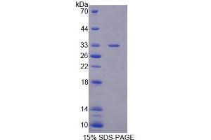 Image no. 1 for Phospholipase C beta 4 (PLCb4) (AA 2-250) protein (His tag) (ABIN6239432)