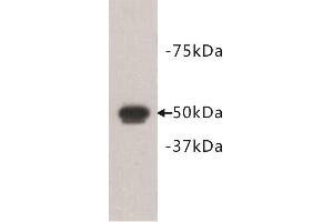 Image no. 1 for anti-FAT Tumor Suppressor Homolog 1 (FAT1) antibody (ABIN1854969)