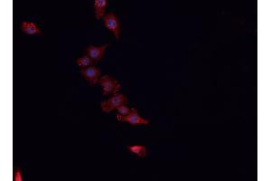 Image no. 2 for anti-Heat Shock 10kDa Protein 1 (Chaperonin 10) (HSPE1) (Internal Region) antibody (ABIN6262388)