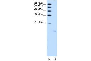 Image no. 2 for anti-Acid Phosphatase 1, Soluble (ACP1) (N-Term) antibody (ABIN2775279)