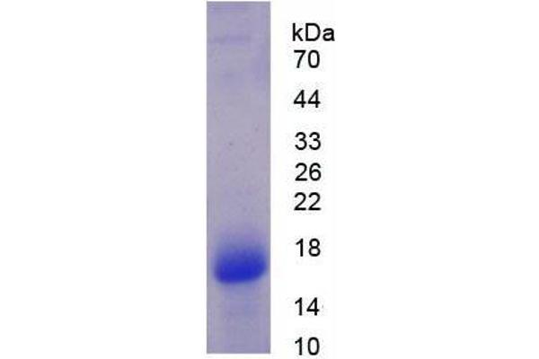 VAPA Protein (AA 1-249) (His tag)