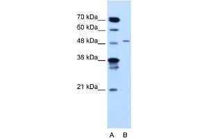 Image no. 1 for anti-Tyrosinase-Related Protein 1 (TYRP1) (N-Term) antibody (ABIN2781813)