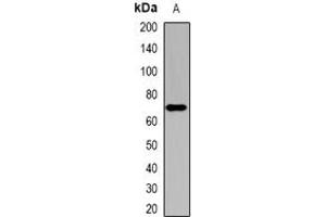 Image no. 1 for anti-Sterol O-Acyltransferase 1 (SOAT1) (full length) antibody (ABIN6006118)