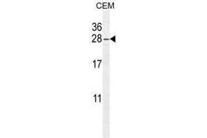 Image no. 1 for anti-ADP-Ribosylation Factor-Like 5B (ARL5B) (AA 129-161), (C-Term) antibody (ABIN950503)