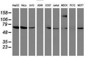 Image no. 3 for anti-Folate Hydrolase (Prostate-Specific Membrane Antigen) 1 (FOLH1) antibody (ABIN1500454)