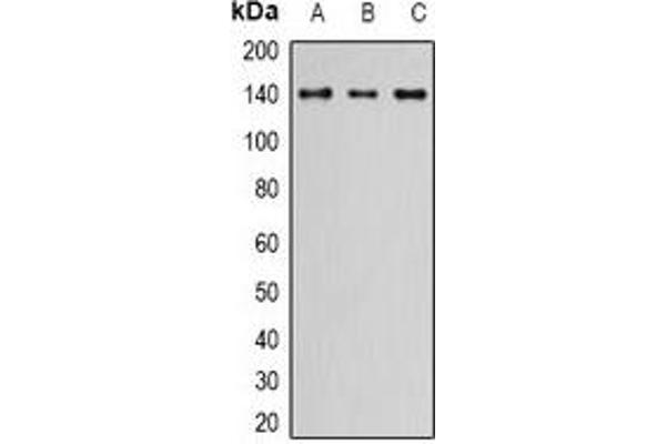 anti-Zinc Finger Protein 335 (ZNF335) antibody