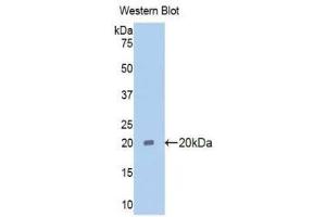 anti-Pim-1 Oncogene (PIM1) (AA 38-177) antibody