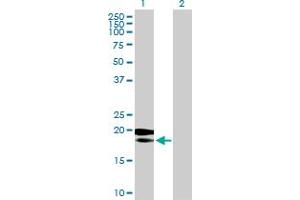 Image no. 1 for anti-Mitochondrial Ribosomal Protein L18 (MRPL18) (AA 1-180) antibody (ABIN526060)