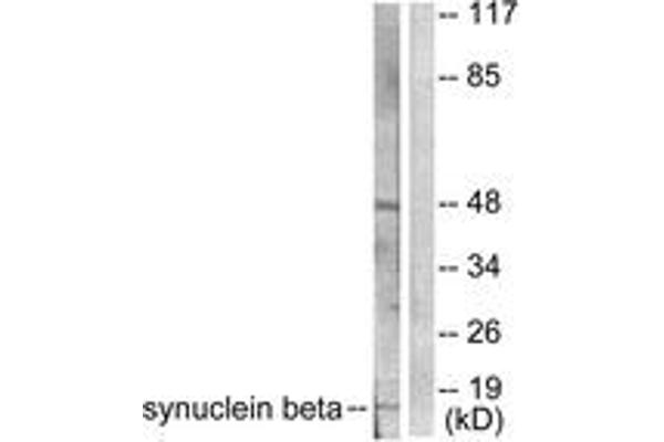 anti-Synuclein, beta (SNCB) (AA 85-134) antibody