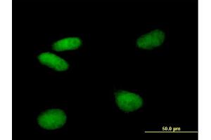 Image no. 2 for anti-Vacuolar Protein Sorting 72 Homolog (S. Cerevisiae) (VPS72) (AA 1-364) antibody (ABIN948532)