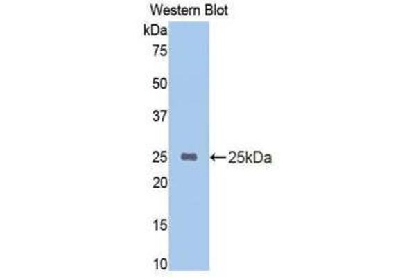 anti-Cytochrome P450, Family 2, Subfamily E, Polypeptide 1 (CYP2E1) (AA 126-309) antibody