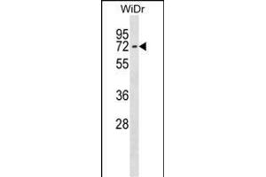 CTNNBL1 Antibody (N-term) (ABIN1539081 and ABIN2848704) western blot analysis in WiDr cell line lysates (35 μg/lane).