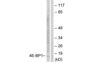 Image no. 2 for anti-Eukaryotic Translation Initiation Factor 4E Binding Protein 1 (EIF4EBP1) (Ser65) antibody (ABIN1847928)