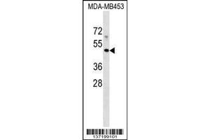 anti-Major Histocompatibility Complex, Class I-Related (MR1) (AA 312-341), (C-Term) antibody