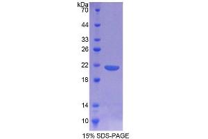 Image no. 1 for CD164 (CD164) (AA 24-160) protein (T7 tag,His tag) (ABIN6238715)