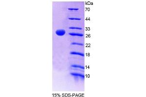 Image no. 1 for serine/arginine-Rich Splicing Factor 1 (SRSF1) (AA 16-224) protein (T7 tag,His tag) (ABIN6239989)