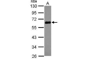Image no. 5 for anti-Sequestosome 1 (SQSTM1) (Internal Region) antibody (ABIN2854836)