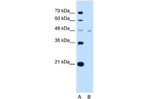 Image no. 1 for anti-Solute Carrier Family 16, Member 1 (Monocarboxylic Acid Transporter 1) (SLC16A1) (Middle Region) antibody (ABIN2781585)