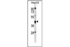 Image no. 3 for anti-Paraoxonase 2 (PON2) (AA 78-107), (N-Term) antibody (ABIN954246)