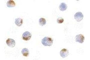 Image no. 1 for anti-Apoptotic Chromatin Condensation Inducer 1 (ACIN1) (Cytoplasmic Domain) antibody (ABIN189910)