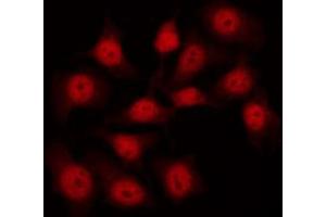 Image no. 4 for anti-Filamin A, alpha (FLNA) (pSer2152) antibody (ABIN6256196)