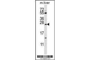 Image no. 1 for anti-Surfactant Protein C (SFTPC) (AA 1-30), (N-Term) antibody (ABIN656267)