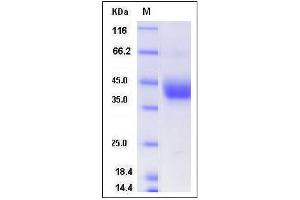 Image no. 1 for ADP-Ribosyltransferase 4 (Dombrock Blood Group) (ART4) (AA 1-263), (Mature) protein (His tag) (ABIN2008598)