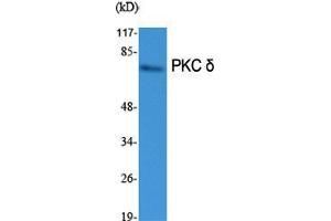 Image no. 2 for anti-Protein Kinase C, delta (PKCd) (Thr292) antibody (ABIN3186471)