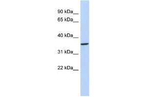 PITX3 anticorps  (N-Term)