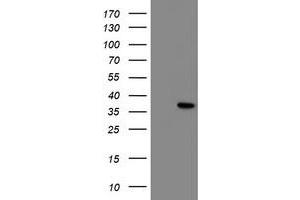 NRIP3 antibody