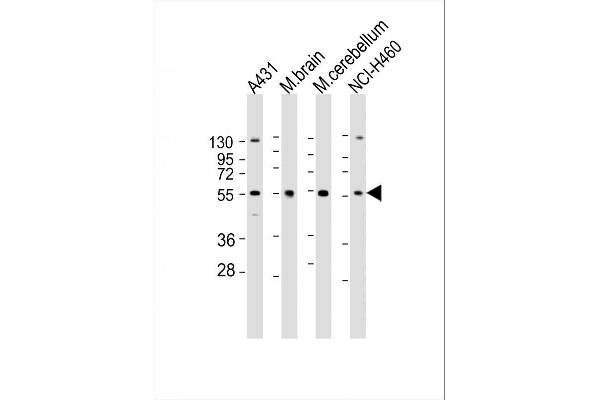 RGMB antibody  (C-Term)