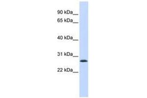 Image no. 1 for anti-LSM12 Homolog B (LSM12B) (C-Term) antibody (ABIN6741194)
