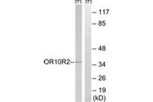Image no. 1 for anti-Melanoma Antigen Family A, 5 (MAGEA5) (AA 68-117) antibody (ABIN1536050)