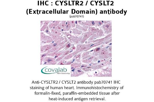 anti-Cysteinyl Leukotriene Receptor 2 (CYSLTR2) (2nd Extracellular Domain) antibody