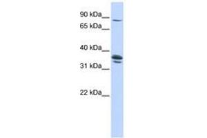 Image no. 1 for anti-Solute Carrier Organic Anion Transporter Family, Member 3A1 (SLCO3A1) (AA 360-409) antibody (ABIN6740849)