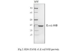 Image no. 1 for Sjogren Syndrome Antigen B (SSB) (Active) protein (ABIN2452175)