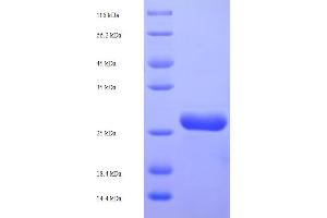 Image no. 1 for NADH Dehydrogenase (Ubiquinone) 1 beta Subcomplex, 5, 16kDa (NDUFB5) (AA 94-189), (partial) protein (His-SUMO Tag) (ABIN5710003)