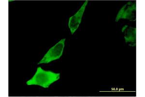 Image no. 4 for anti-Brain-Derived Neurotrophic Factor (BDNF) (AA 1-247) antibody (ABIN513711)