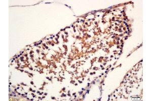 anti-Sperm Associated Antigen 16 (SPAG16) (AA 439-485) antibody