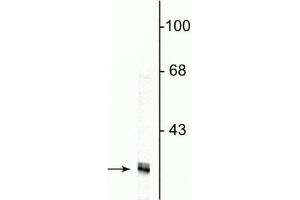Image no. 3 for anti-Fibrillarin (FBL) antibody (ABIN361375)
