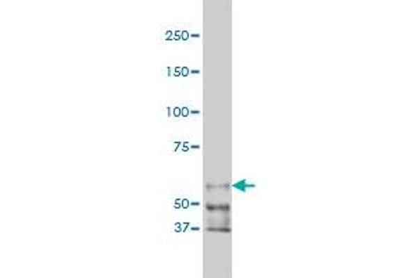 PAK1 Antikörper  (AA 191-280)