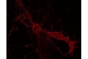 Indirect immunostaining of PFA fixed rat hippocampus neurons (dilution 1 : 100).