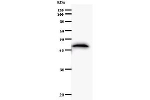 Image no. 1 for anti-Homeobox C11 (HOXC11) antibody (ABIN930923)