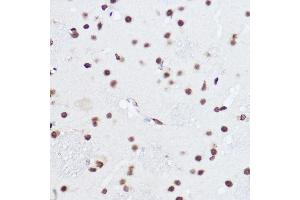 SART1 antibody  (AA 1-255)