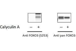 Image no. 2 for Forkhead Box O3 (FOXO3) ELISA Kit (ABIN5526709)