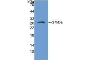 MYH1 antibody  (AA 585-794)