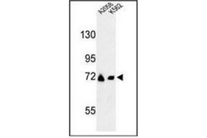Image no. 3 for anti-Glutamine-Fructose-6-Phosphate Transaminase 2 (GFPT2) (AA 181-210), (Middle Region) antibody (ABIN952503)